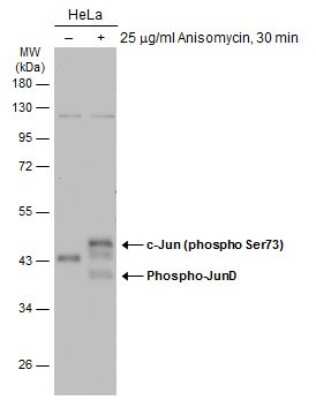 Western Blot: c-jun [p Ser73] Antibody [NBP3-13304]
